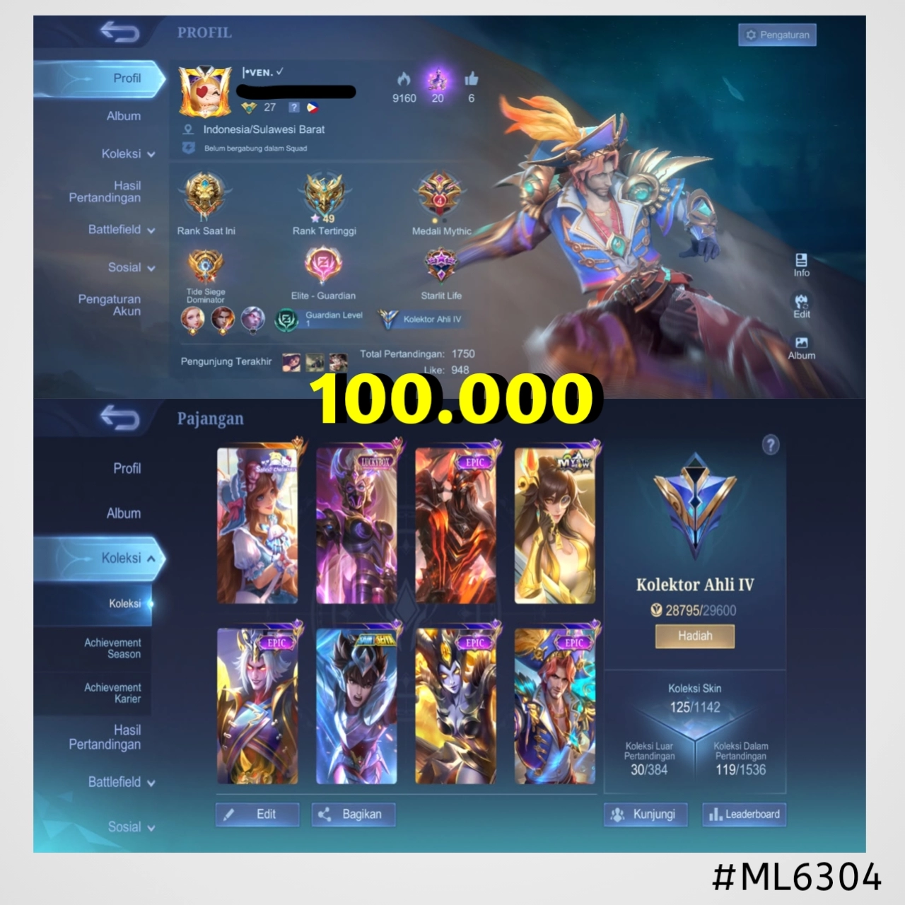 STOK ML #ML6304